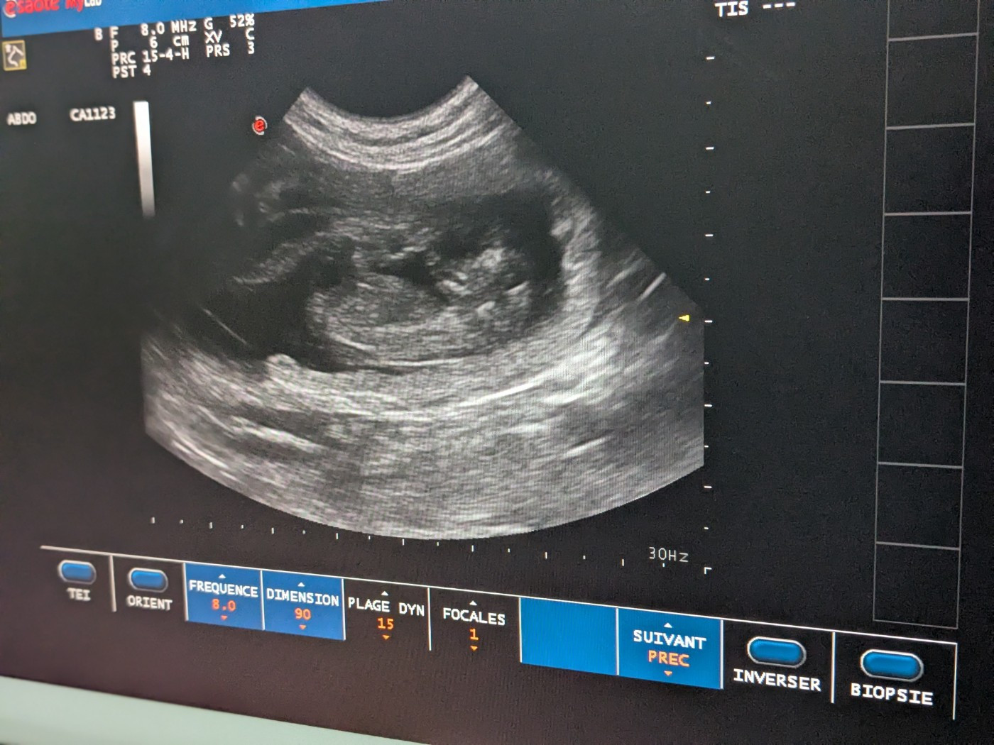 of the marjohrita - Première portée 2026 Tiiu et Scaramouche